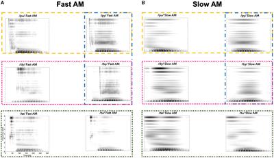 An auditory perspective on phonological development in infancy